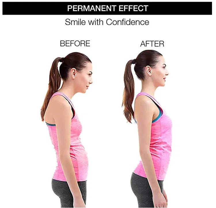 Adjustable Posture Corrector Shoulder Brace